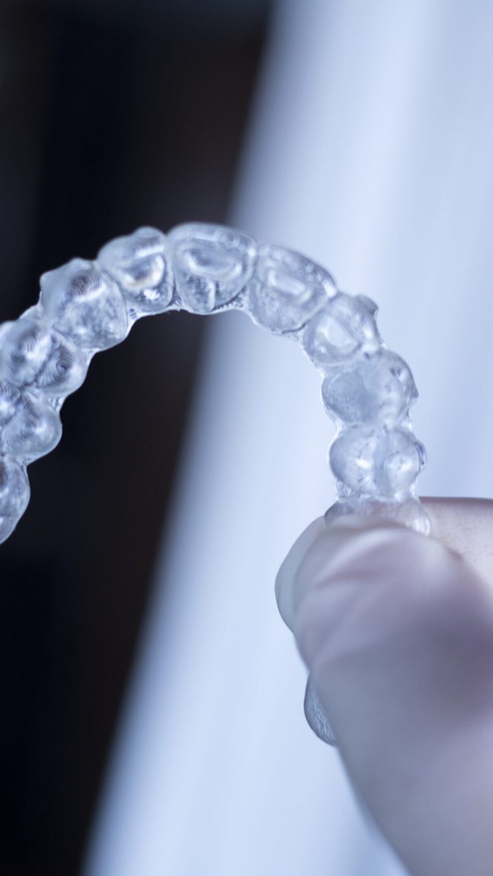 Fotografia analogica artistica bodas Madrid España Barcelona Costa del Sol Invisible dental teeth aligners brackets used to align each tooth in cosmetic dentistry for patients.