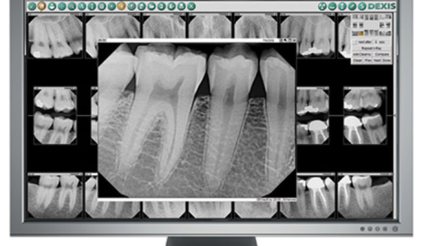 dental xray=